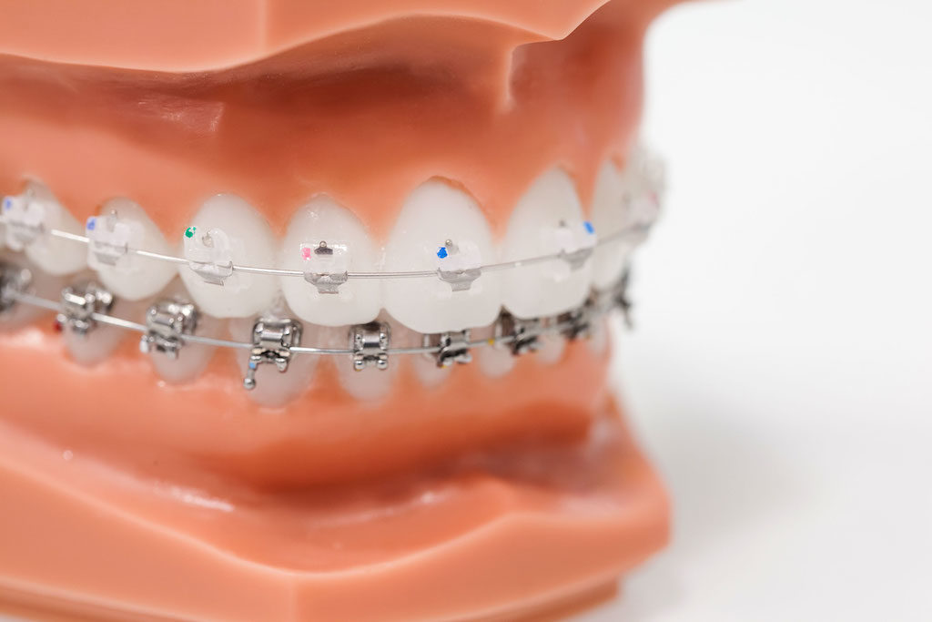 Cabinet d'Orthodontie du Dr de Brondeau et Dr Leman-l'Huillier à Cenon